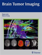 Marco Essig, Raja Jain, Rajan Jain - Brain Tumor Imaging
