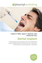 Agne F Vandome, John McBrewster, Frederic P. Miller, Agnes F. Vandome - Dental implant