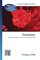Edward R. Miller-Jones, Edwar R Miller-Jones - Thrombosis