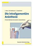 Christop Benz, Christoph Benz, Mar Prothmann, Marc Prothmann, Lothar Taubenheim - Die intraligamentäre Anästhesie