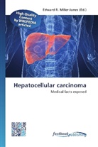 Edward R. Miller-Jones, Edwar R Miller-Jones - Hepatocellular carcinoma