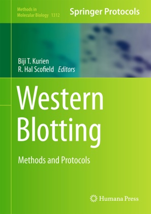 Hal Scofield, Hal Scofield, Biji T. Kurien, R. Hal Scofield, Bij T Kurien, … - Western Blotting Methods and Protocols
