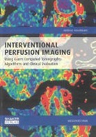 Andreas Fieselmann - Interventional Perfusion Imaging Using C-arm Computed Tomography: Algorithms and Clinical Evaluation