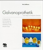 Andreas Hoffmann, Jakob Wirz, Andreas Hoffmann, Jakob Wirz - Galvanoprothetik