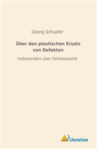 Georg Schueler - Über den plastischen Ersatz von Defekten