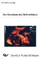Michael Zeising - Der Nasciturus im Zivilverfahren