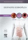 Javier . . . [et al. ] Molina Infante - Esofagitis eosinofílica : clínicas iberoamericanas de gastroenterología y hepatología