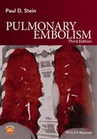 Paul D Stein, Paul D. Stein, Paul D. (College of Osteopathic Medicine Stein, PD Stein - Pulmonary Embolism