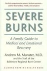 Glorya Hale, Munster, Andrew M Munster, Andrew M. Munster - Severe Burns
