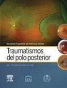 Sociedad Española de Retina y Vítreo - Traumatismos del polo posterior