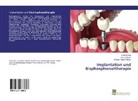 Michae Maj, Michael Maj, Marius Meier, Drita Turhani, Dritan Turhani - Implantation und Bisphosphonattherapie