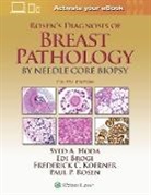 Edi Brogi, Syed Hoda, Syed A. Hoda, Syed A. Brogi Hoda, Syed A. Rosen Hoda, Frederick C. Koerner... - Rosen''s Diagnosis of Breast Pathology By Needle Core Biopsy