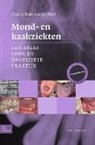I. Van Der Waal, I van der Waal, I. van der Waal - Mond- en kaakziekten