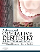 David W. Bartlett, David Ricketts, David (Professor of Cariology and Conservative Dentistry/Honorary Consultant in Restorative Dentistry Ricketts, David W. Bartlett, David W. Bartlett, David Ricketts... - Advanced Operative Dentistry