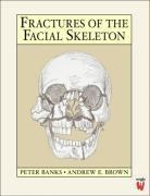 Peter Banks - Fractures of the Facial Skeleton