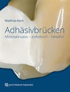 Matthias Kern - Adhäsivbrücken
