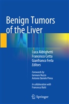 Luca Aldrighetti, Francesc Cetta, Francesco Cetta, Gianfranco Ferla - Benign Tumors of the Liver