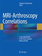 Stephen F. Brockmeier, Stephe F Brockmeier, Stephen F Brockmeier - MRI-Arthroscopy Correlations