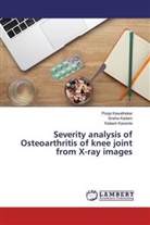 Sneh Kadam, Sneha Kadam, Kailash Karande, Pooj Kawathekar, Pooja Kawathekar - Severity analysis of Osteoarthritis of knee joint from X-ray images