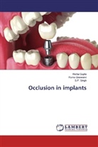 Rom Goswami, Roma Goswami, Rich Gupta, Richa Gupta, S P Singh, S. P. Singh... - Occlusion in implants
