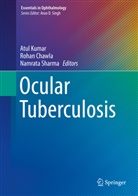 Roha Chawla, Rohan Chawla, Atul Kumar, Namrata Sharma - Ocular Tuberculosis