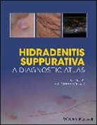 G Micali, Giuseppe Micali, Giuseppe (Dermatology Clinic Micali, Giuseppe Micali, Giuseppe (Dermatology Clinic Micali, Micali Giuseppe - Hidradenitis Suppurativa