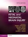 David K Stevenson, David K. Stevenson, David K. (Stanford University Stevenson, William Benitz, William E. Benitz, William E. (Stanford University Benitz... - Fetal and Neonatal Brain Injury