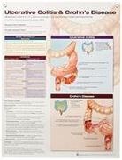Anatomical Chart Company - Ulcerative Colitis & Crohn''s Disease Anatomical Chart Laminated