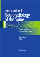 Mari Muto, Mario Muto - Interventional Neuroradiology of the Spine