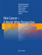 Reinhard Dummer, Nagwa M. Elwan, Adèle Green, Keiji Iwatsuki, Keiji Iwatsuki et al, Mark R. Pittelkow... - Skin Cancer - A World-Wide Perspective