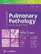 Philip Cagle, Philip T. Cagle, Cagle Allen Barrios Bedrossian - Pulmonary Pathology