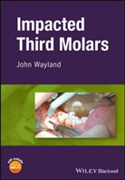 Wayland, J Wayland, John Wayland - Impacted Third Molars