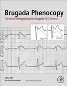 Adrian Baranchuk, Adrian (EDT) Baranchuk, Adrian Baranchuk, Adrian (Professor of Medicine Baranchuk, Baranchuk Adrian - Brugada Phenocopy