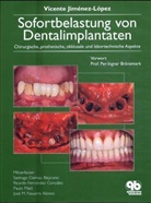 Vicente Jimenez-Lopez - Sofortbelastung von Dentalimplantaten