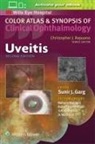 Sunir Garg, Sunir J. Garg - Uveitis