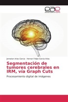 Jonnata Arias Garcia, Jonnatan Arias Garcia, Hernan Felipe Garcia Arias - Segmentación de tumores cerebrales en IRM, vía Graph Cuts