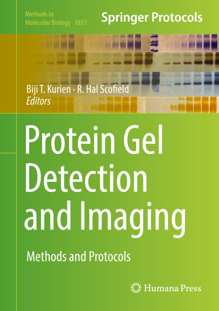 Hal Scofield, Hal Scofield, Biji T. Kurien, Hal Scofield, R. Hal Scofield, … - Protein Gel Detection and Imaging Methods and Protocols