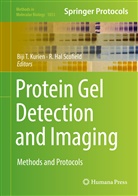 Hal Scofield, Hal Scofield, Biji T. Kurien, Hal Scofield, R. Hal Scofield, Bij T Kurien... - Protein Gel Detection and Imaging