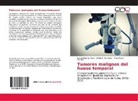 Evely Bigorra Hevia, Evelyn Bigorra Hevia, Nélido González, Nélido E González, Nélido E. González, Morales... - Tumores malignos del hueso temporal