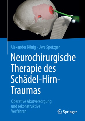 Alexande König, Alexander König, Uwe Spetzger - Neurochirurgische Therapie des Schädel-Hirn-Traumas Operative Akutversorgung und rekonstruktive Verfahren