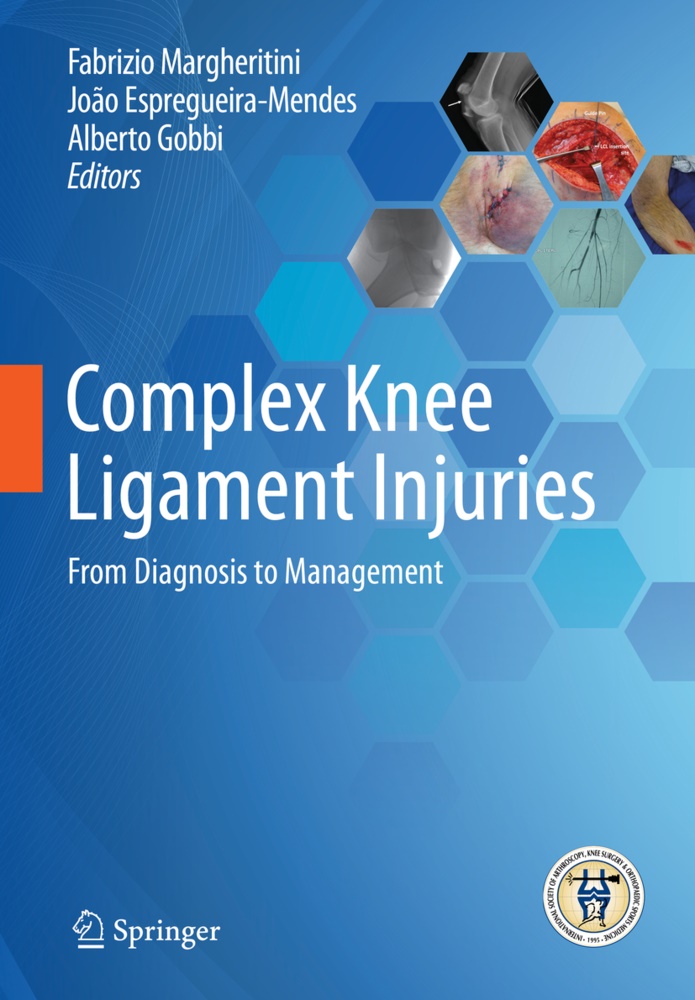 Joã Espregueira-Mendes, João Espregueira-Mendes, Alberto Gobbi, Fabrizio Margheritini - Complex Knee Ligament Injuries - From Diagnosis to Management