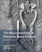 Megan Brickley, Megan (Professor and Tier 1 Canada Resea Brickley, Megan (Professor and Tier 1 Canada Research Chair in the Bioarchaeology of Human Disease at the Department of Anthropology Brickley, Megan B Brickley, Megan B. Brickley, Megan B. (Professor and Tier 1 Canada Re Brickley... - Bioarchaeology of Metabolic Bone Disease