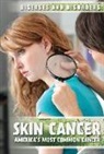 Peter Kurch - Skin Cancer