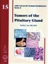 Sylvia L. Asa, Sylvia L. Asa - Tumors of the Pituitary Gland