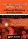 Javier Montero, Sandeep Saxena - Optical Coherence Tomography in Macular Diseases and Glaucoma