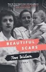 Tom Wilson - Beautiful Scars