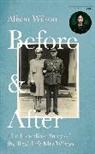 Alison Wilson - Before & After