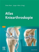 Höher, Jürgen Höher, Höher (Prof. Dr. me, Diete Rixen, Dieter Rixen, Diete Rixen (Prof. Dr. med.)... - Atlas Kniearthroskopie