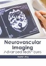 Holden Ray - Neurovascular Imaging: Advanced Techniques