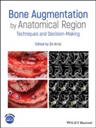 Z Artzi, Zvi Artzi, Zvi (Tel Aviv University Artzi, Zv Artzi, Zvi Artzi - Bone Augmentation By Anatomical Region
